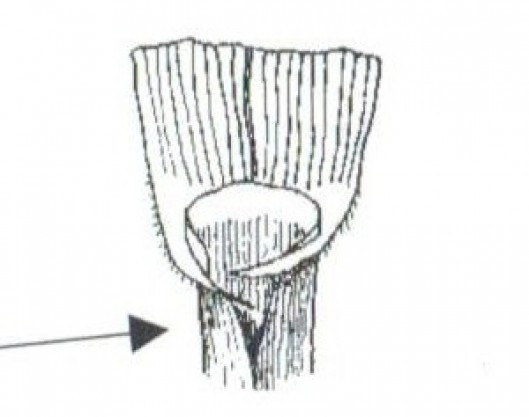 fescue2.529x0